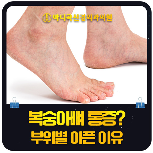 복숭아뼈 통증, 원인에 따라 어떻게 다른가요?