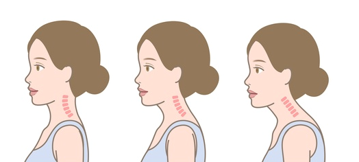 거북목증후군 셀프 교정, 효과 없는 이유는 무엇일까요? 관련 해부 구조 그림