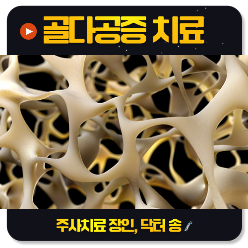 골다공증 진단을 받았다면 무엇부터 해야 할까요?