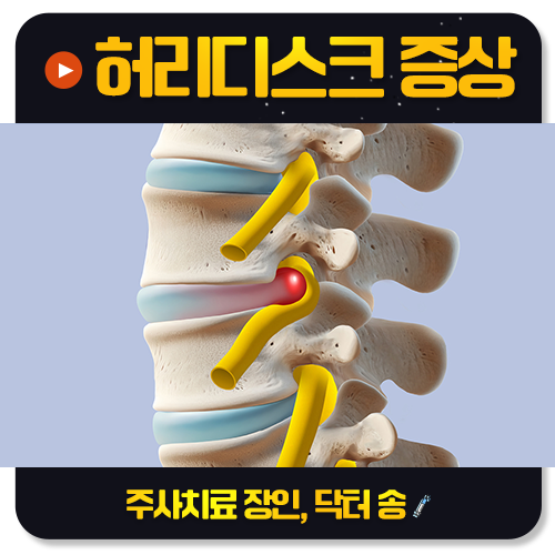 20대인데 허리디스크라니, 원인이 뭘까요?