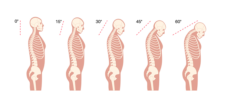 경기 도수치료, 거북목증후군에 효과가 있고 목을 꺾지는 않나요? 관련 해부 구조 그림