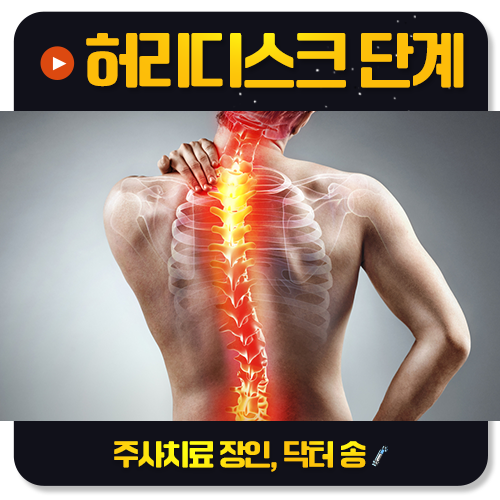 다리 저림과 힘 빠짐, 허리디스크 증상일 수 있나요?