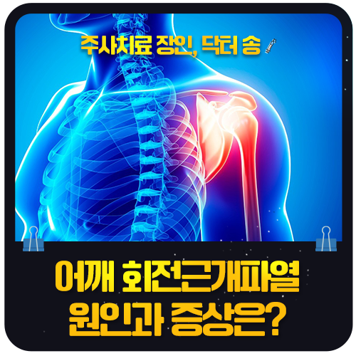 어깨 회전근개파열 원인과 증상, 팔을 들 때 어깨가 찌릿하다면?
