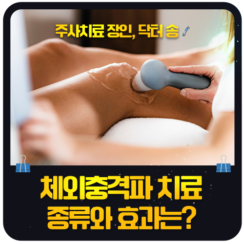 체외충격파 치료 종류와 효과, 어떤 통증에 쓰이나요?